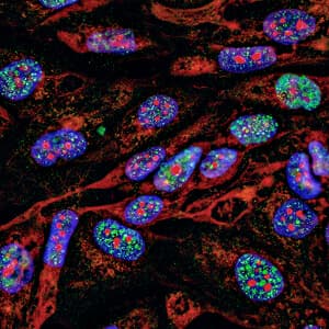 Illustration representing cancer immunotherapy